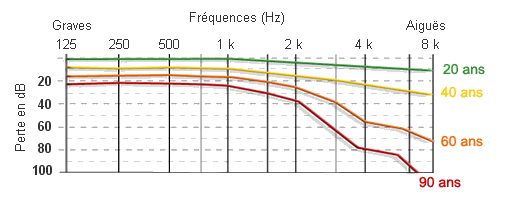 Exemples d'audiogrammes selon l'âge pour représenter une presbyacousie